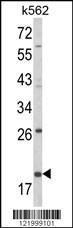 Anti-KLRD1 Rabbit Polyclonal Antibody (FITC (Fluorescein))