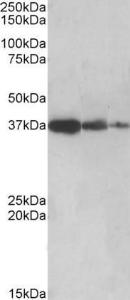 Anti-PPP2R4 Antibody (A83050) (0.5 µg/ml) staining of Human Liver lysate (lane 1), Mouse Liver (lane 2) and Rat Liver (lane 3) (35 µg protein in RIPA buffer). Primary incubation was 1 hour. Detected by chemiluminescence