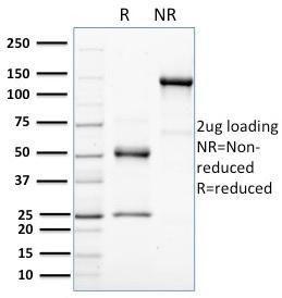 SDS-PAGE analysis of Anti-HER4 Antibody [HFR-1] under non-reduced and reduced conditions; showing intact IgG and intact heavy and light chains, respectively. SDS-PAGE analysis confirms the integrity and purity of the antibody