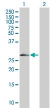 Anti-SPINT2 Mouse Polyclonal Antibody