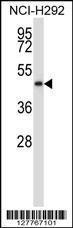 Anti-NADK2 Rabbit Polyclonal Antibody (AP (Alkaline Phosphatase))