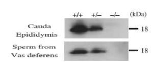 Anti-CD52 antibody