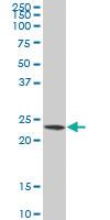 Anti-PSMB3 Mouse Polyclonal Antibody