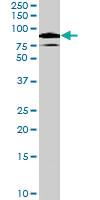 Anti-XRCC5 Goat Polyclonal Antibody