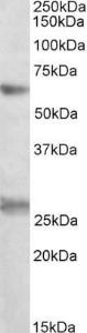 Anti-EIF2B4 Antibody (A83051) (0.3 µg/ml) staining of K562 lysate (35 µg protein in RIPA buffer). Primary incubation was 1 hour. Detected by chemiluminescence