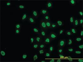 Anti-ARID1B Mouse Monoclonal Antibody [clone: 2D2]