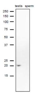 Anti-CD52 antibody