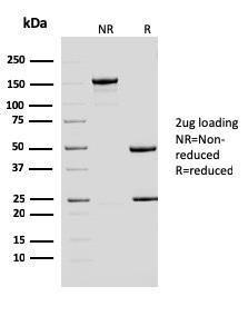 SDS-PAGE analysis of Anti-ERCC1 Antibody [ERCC1/2683] under non-reduced and reduced conditions; showing intact IgG and intact heavy and light chains, respectively SDS-PAGE analysis confirms the integrity and purity of the antibody