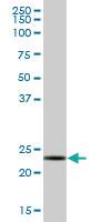 Anti-PSMB3 Mouse Polyclonal Antibody