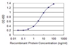 Anti-WTAP Mouse Monoclonal Antibody [clone: 1B11]