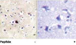 Anti-NR3C1 Rabbit Polyclonal Antibody