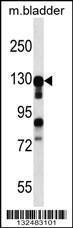 Anti-MKL2 Rabbit Polyclonal Antibody (AP (Alkaline Phosphatase))