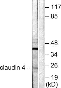 Western blot analysis of lysates from HeLa cells using Anti-Claudin 4 Antibody The right hand lane represents a negative control, where the antibody is blocked by the immunising peptide