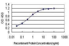 Anti-ARID1B Mouse Monoclonal Antibody [clone: 2D2]