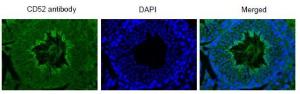 Anti-CD52 antibody