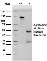 SDS-PAGE analysis of Anti-pan Cytokeratin Antibody [PCK/3150] under non-reduced and reduced conditions; showing intact IgG and intact heavy and light chains, respectively. SDS-PAGE analysis confirms the integrity and purity of the antibody