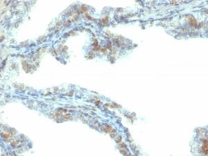 Anti-ERG antibody