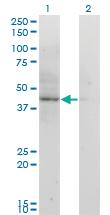 Anti-ACAT2 Mouse Monoclonal Antibody [clone: 4A5]