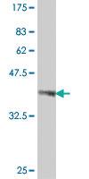 Anti-UGT2B10 Mouse Polyclonal Antibody