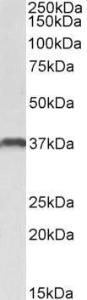 Anti-CLEC12A Antibody (A83053) (0.3µg/ml) staining of U937 lysate (35µg protein in RIPA buffer). Primary incubation was 1 hour. Detected by chemiluminescence.