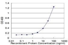 Anti-ACAT2 Mouse Monoclonal Antibody [clone: 4A5]