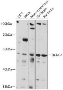 Western blot analysis of extracts of various cell lines, using Anti-DCDC2 Antibody (A307780) at 1:1000 dilution. The secondary Antibody was Goat Anti-Rabbit IgG H&L Antibody (HRP) at 1:10000 dilution. Lysates/proteins were present at 25 µg per lane