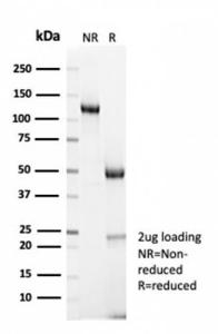 SDS-PAGE analysis of Anti-Cyclin B1 Antibody [CCNB1/7030R] under non-reduced and reduced conditions; showing intact IgG and intact heavy and light chains, respectively SDS-PAGE analysis confirms the integrity and purity of the antibody