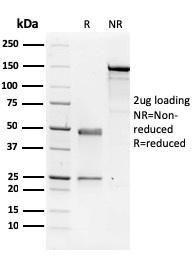 SDS-PAGE analysis of Anti-NME1 Antibody [CPTC-NME1-2] under non-reduced and reduced conditions; showing intact IgG and intact heavy and light chains, respectively. SDS-PAGE analysis confirms the integrity and purity of the antibody