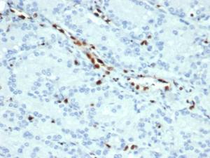 Anti-ERG Rabbit Recombinant Antibody [clone: ERG/22R]