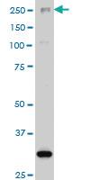 Anti-ARID1B Mouse Monoclonal Antibody [clone: 2F2]