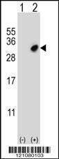 Anti-GSTO2 Rabbit Polyclonal Antibody (AP (Alkaline Phosphatase))