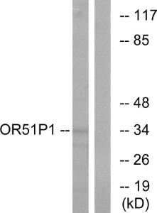 Antibody anti-OR51D1 A100407-100 100 µg