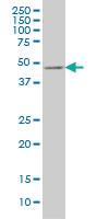 Anti-E2F3 Mouse Monoclonal Antibody [clone: 5F7]