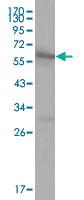 Anti-ESR1 Mouse Monoclonal Antibody [clone: 2G112B3]