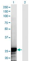 Anti-NOL3 Mouse Monoclonal Antibody [clone: 6F5]