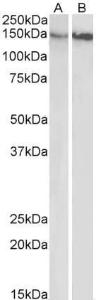 Anti-ITGB1 Antibody (A83054) (0.5 µg/ml) staining of Gastrointestinal cancer (A) and Gall Bladder cancer (B) lysates (35 µg protein in RIPA buffer). Primary incubation was 1 hour. Detected by chemilu minescence