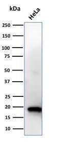 Western blot analysis of HeLa cell lysate using Anti-NME1 Antibody [CPTC-NME1-2]