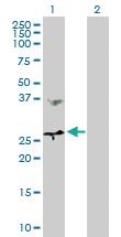 Anti-MTHFD2 Rabbit Polyclonal Antibody