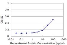 Anti-AKAP12 Mouse Monoclonal Antibody [clone: 3C3]