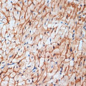 Anti-alpha Sarcoglycan Rabbit Monoclonal Antibody [clone: ARC2280]