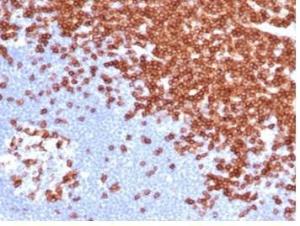 Anti-CD3 epsilon antibody