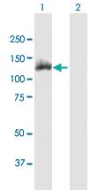 Anti-ACLY Mouse Polyclonal Antibody