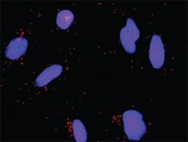 Anti-E2F3 Mouse Monoclonal Antibody [clone: 5F7]