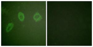 Immunofluorescence analysis of HUVEC cells using Anti-HER2 Antibody. The right hand panel represents a negative control, where the antibody was pre-incubated with the immunising peptide