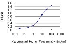 Anti-E2F3 Mouse Monoclonal Antibody [clone: 5F7]