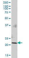 Anti-PMVK Mouse Polyclonal Antibody