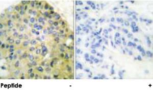 Anti-IKBKB Rabbit Polyclonal Antibody