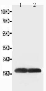 Anti-Superoxide Dismutase 1 Rabbit Polyclonal Antibody