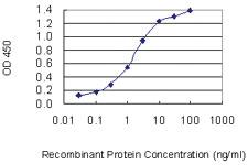 Anti-E2F3 Mouse Monoclonal Antibody [clone: 5F7]