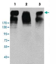 Anti-MKI67 Mouse Monoclonal Antibody [clone: 8D5]